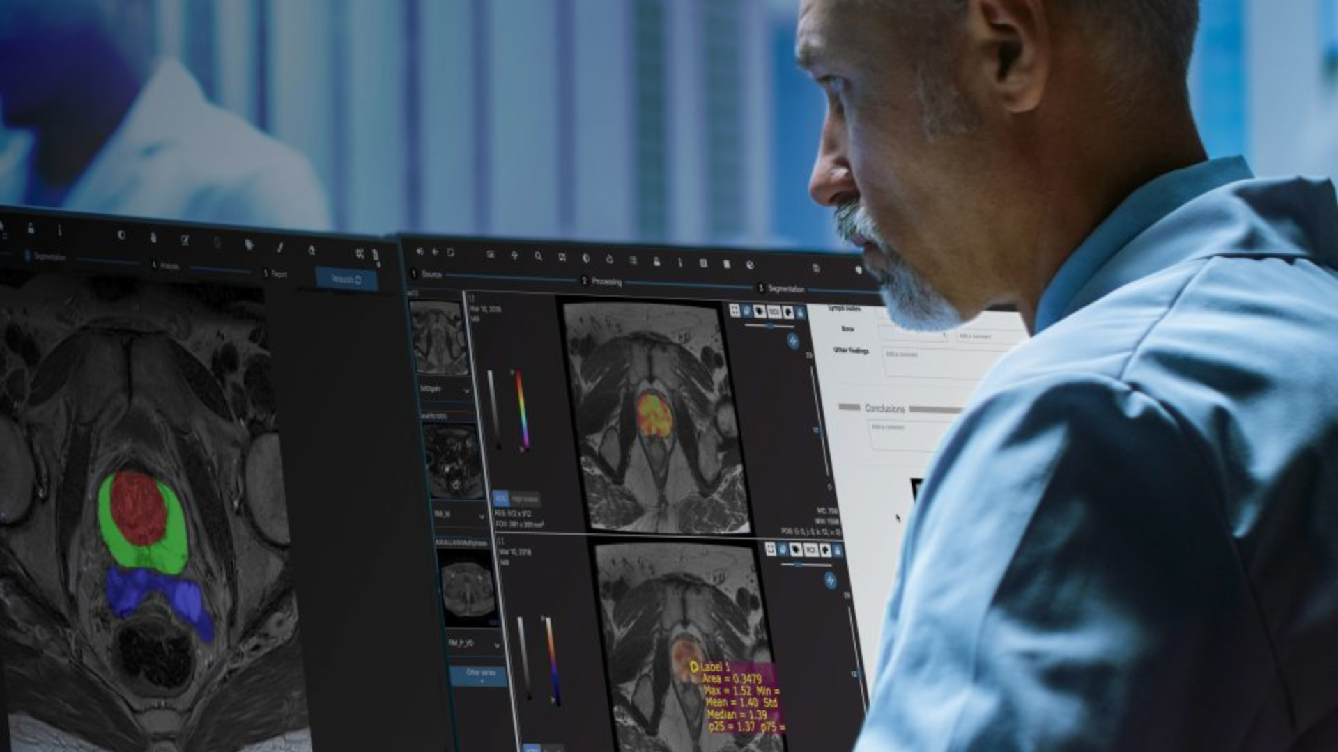 Microsoft y Quibim colaboran en el desarrollo de biopsias virtuales con Inteligencia Artificial
