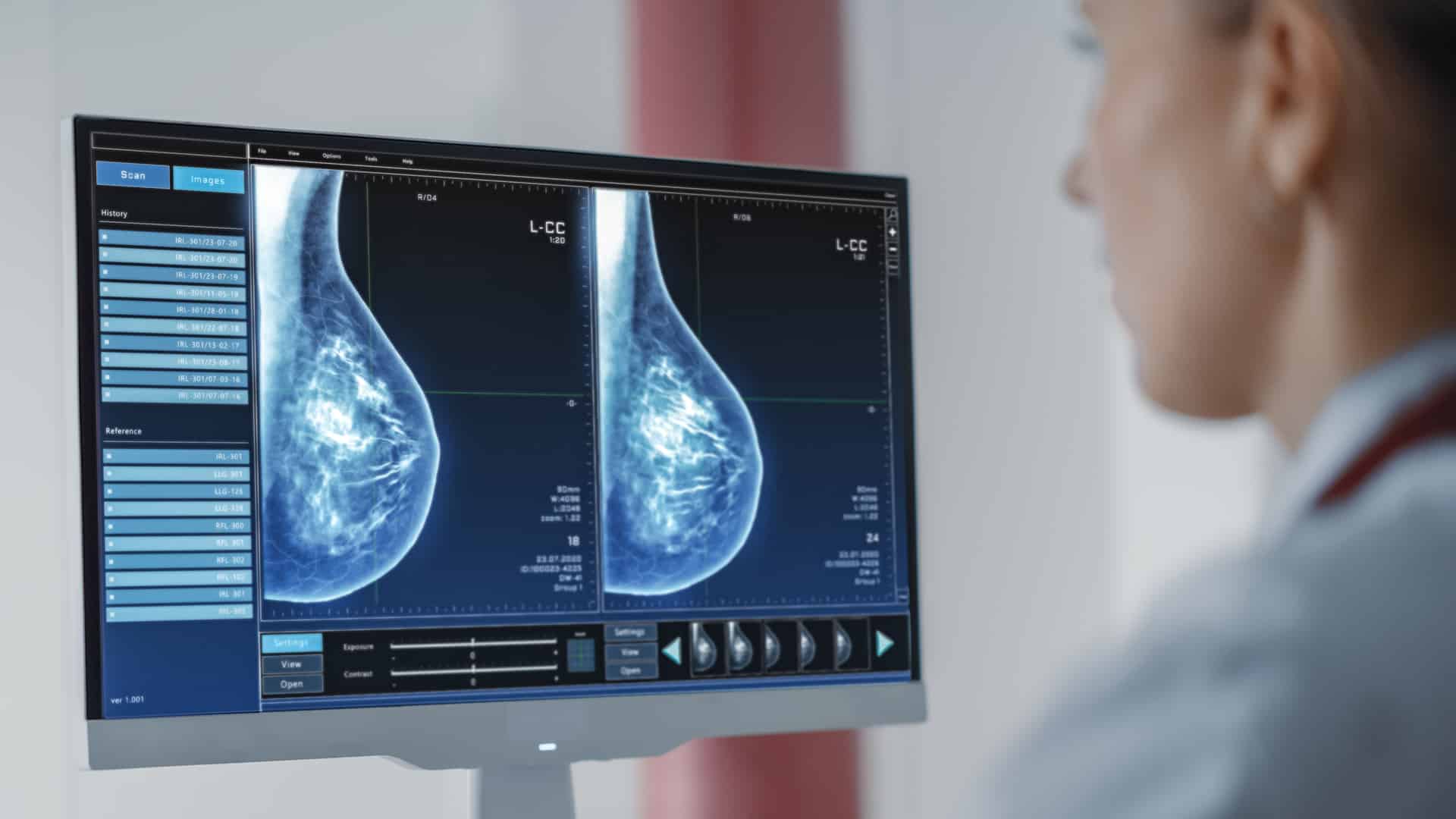Nvidia despliega una plataforma de IA en los hospitales del SNS